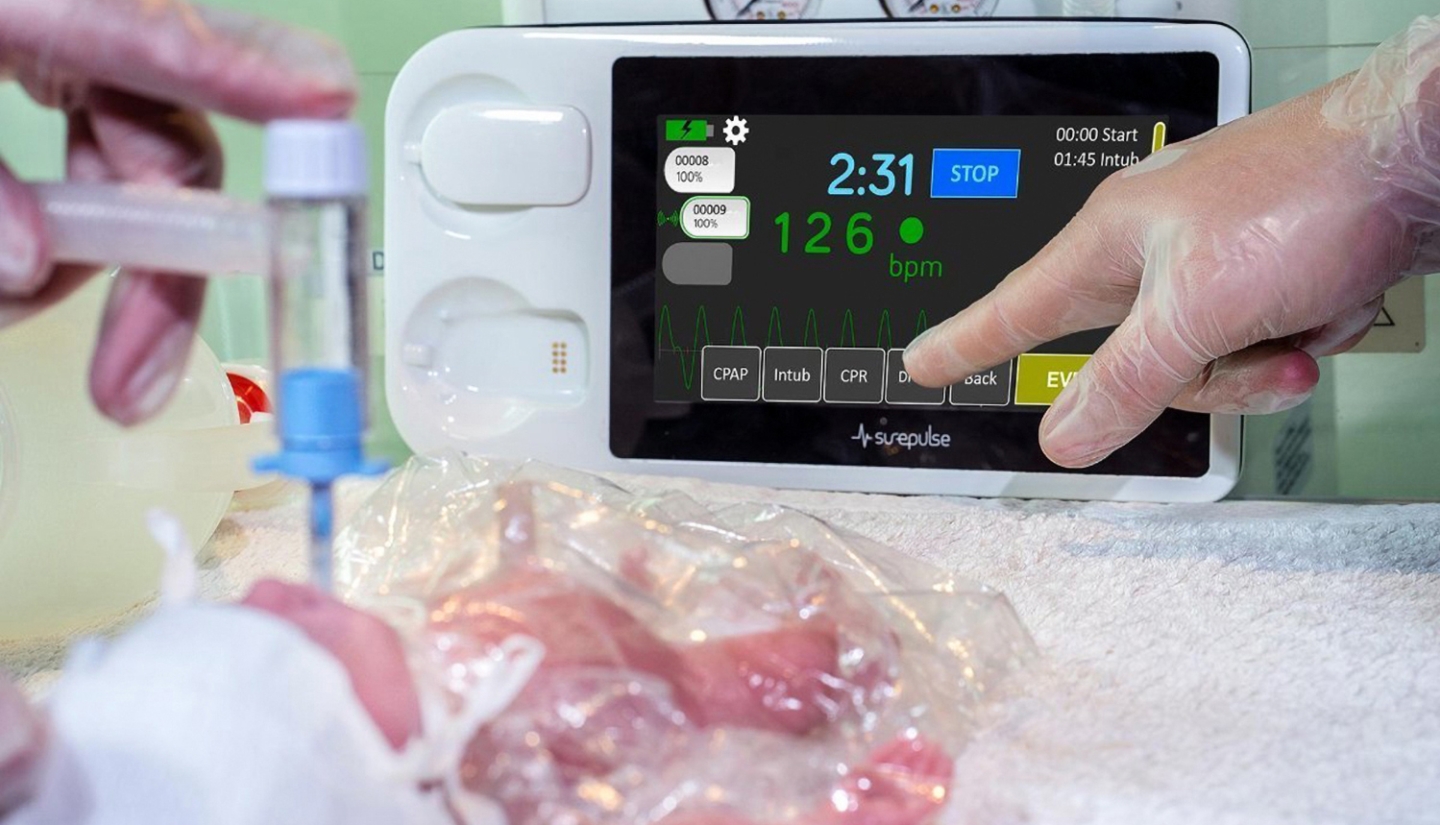 Neonatal Infant monitor design and development of this ground-breaking device